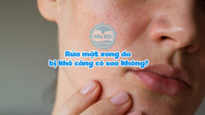 Rửa mặt xong da bị khô căng có sao không? Cách khắc phục ra sao?